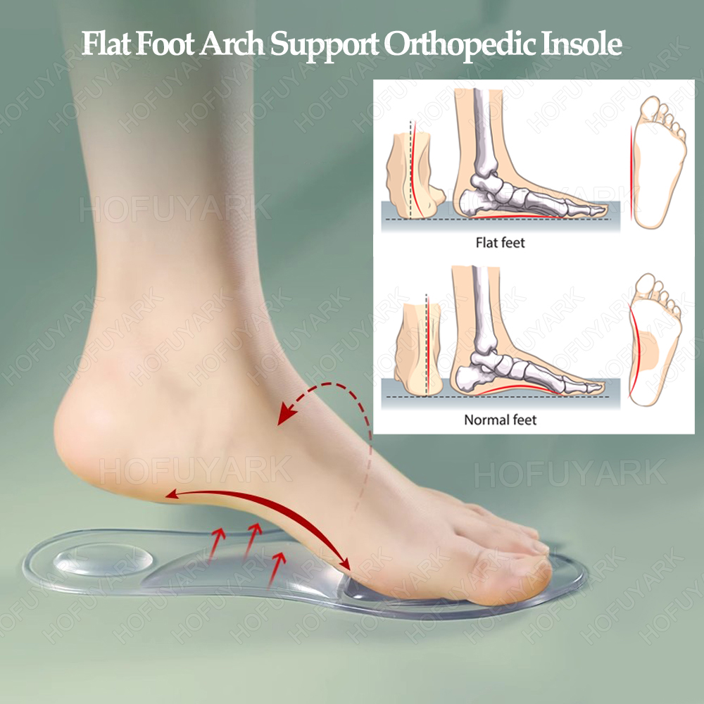 Silicone Gel Insoles Orthopedi - Women'S Shoes For Plantar Fasciitis ulasan dan harga